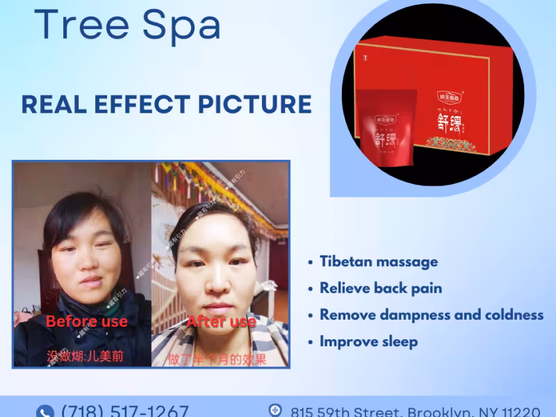 Tree Spa