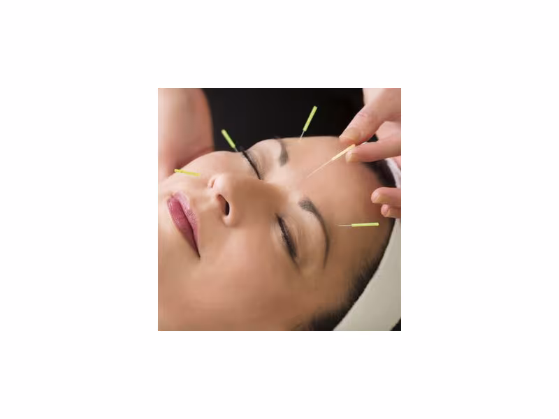 Cheng Acupuncture Wellness