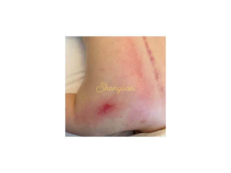 Shanglian Therapeutic Bodywork